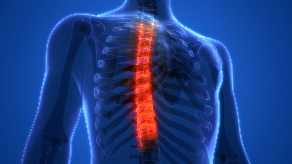 osteochondroza hrudní páteře