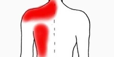 bolest pod levou lopatkou zezadu