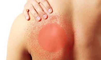 bolest pod levou lopatkou